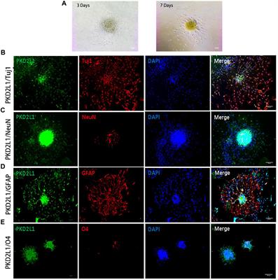 The roles and applications of neural stem cells in spinal cord injury repair